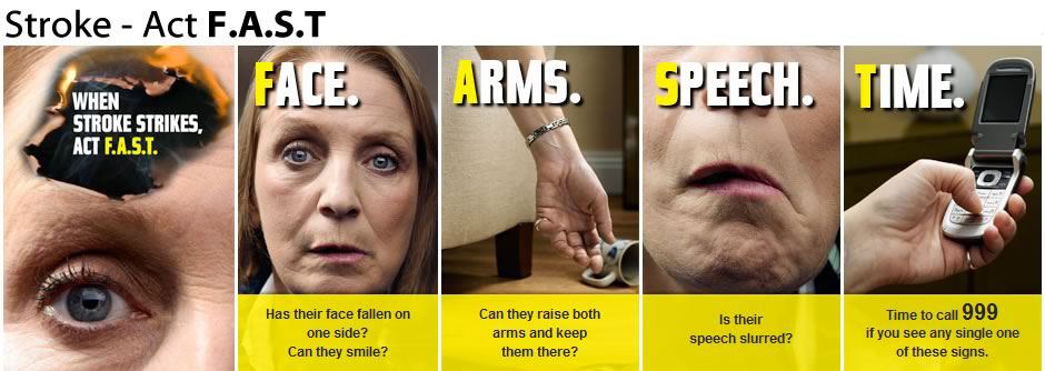Stroke - Act FAST - Face, Arms, Speech - time to call 999